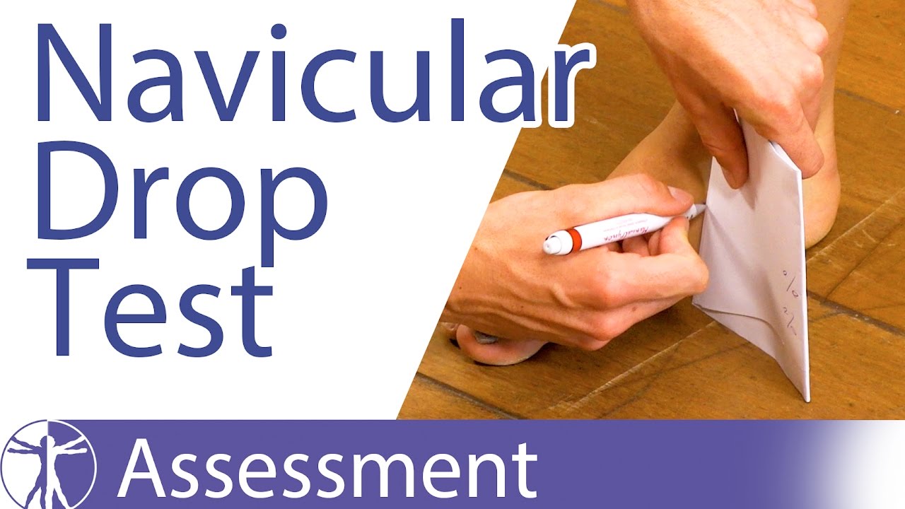 The Navicular Drop Test for Foot Overpronation