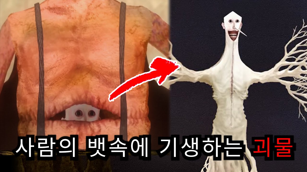 아날로그 호러 - 불안장애를 겪는 사람의 일상(Desiderio)