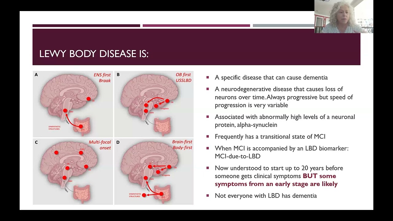 2025 Updates about Diagnosis, Research. & Treatment by UNC's Dr. Bozoki