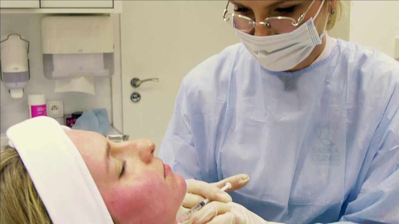 Linerase - atelokolagenowy zabieg odmładzający skórę (Saska Clinic)