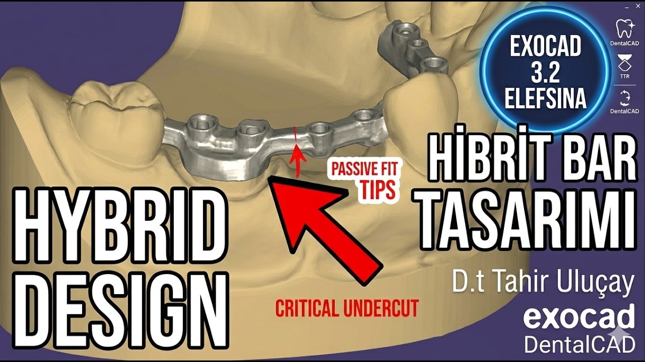 Exocad Offset metal tasarım nasıl yapılır...