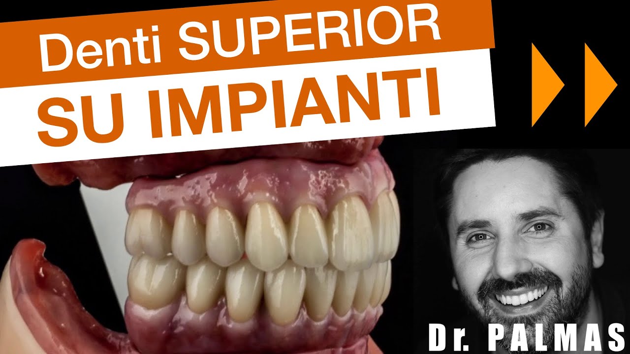 Denti Fissi su Impianti in Zirconio 🔥Denti SUPERIOR: i più avanzati al mondo