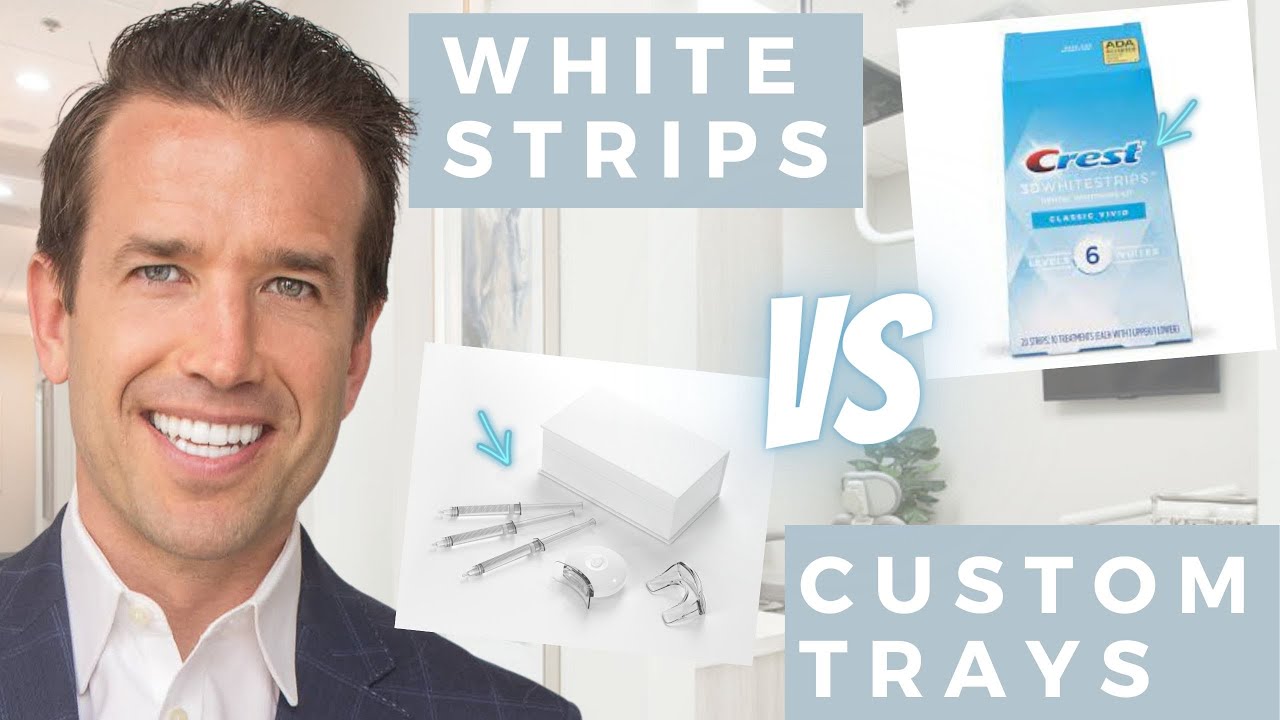 Отбеливание зубов | Полоски Crest White Strips против индивидуальных отбеливающих капп