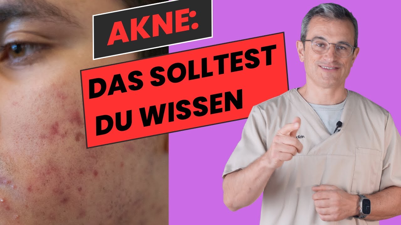 Umfassender Ratgeber zur Akne-Behandlung: Tipps & Therapien von Dr. Kasten #akne #aknebehandlung
