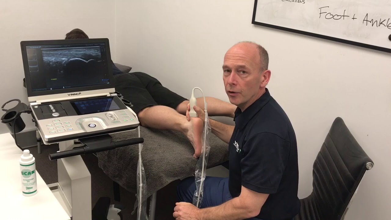 Achilles Tendon: how to Ultrasound Scan