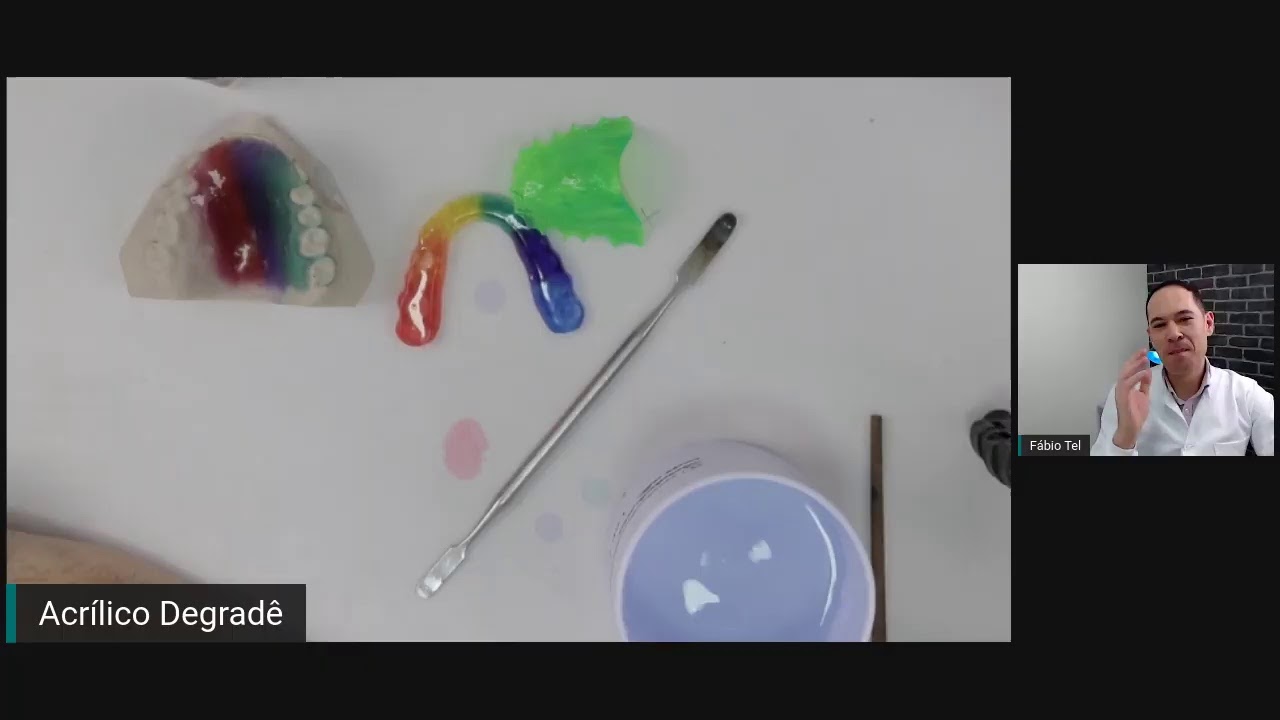 APARELHOS ORTODONTICOS Como fazer o acrílico com várias cores degradê