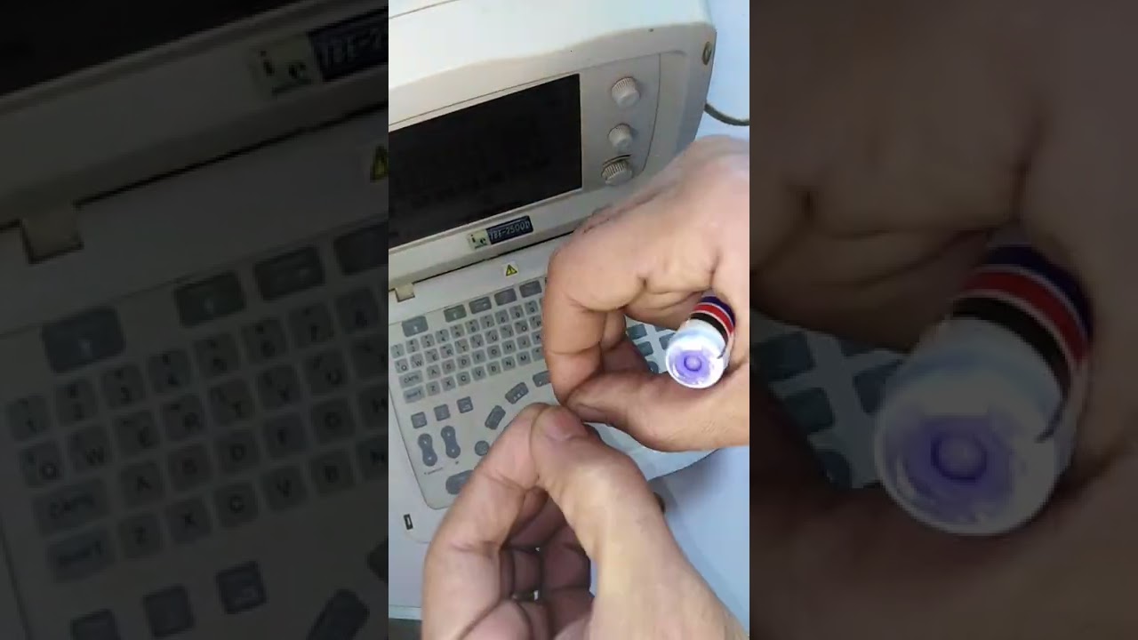 إصلاح السونار.. عصام مندور