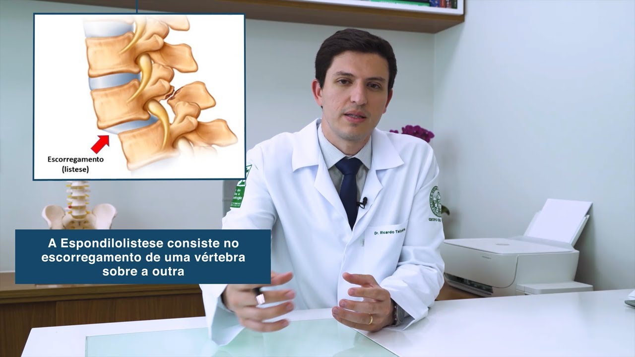 Espondilolistese e espondilólise - Dr Ricardo Teixeira