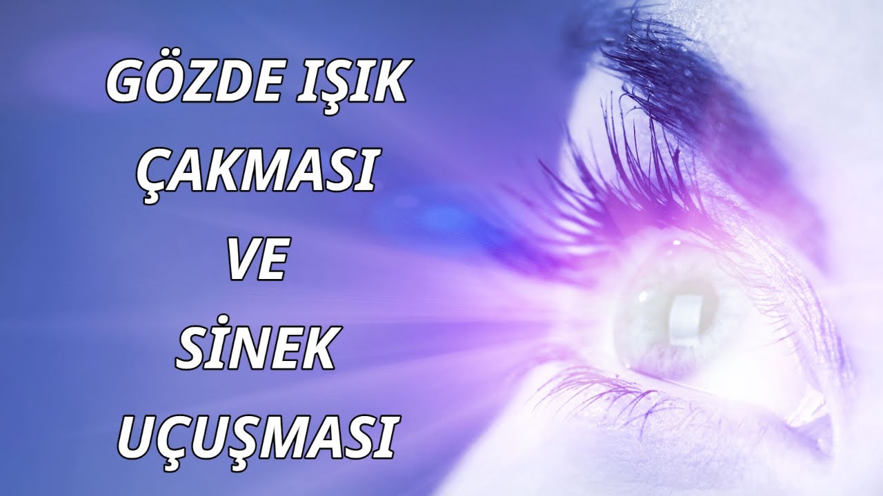 Sinek Uçuşması Işık Çakması