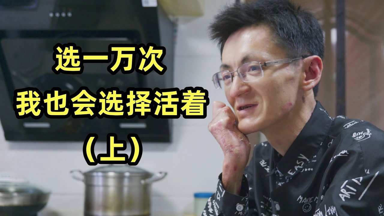 34岁身患罕见病父母双亡：哪怕选一万次，我都会选择活着（上）
