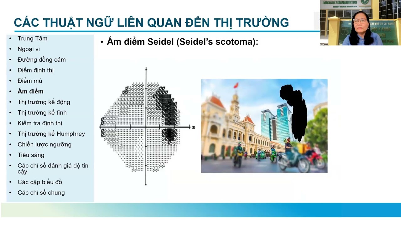 Bài giảng: Thị trường trong Glôcôm