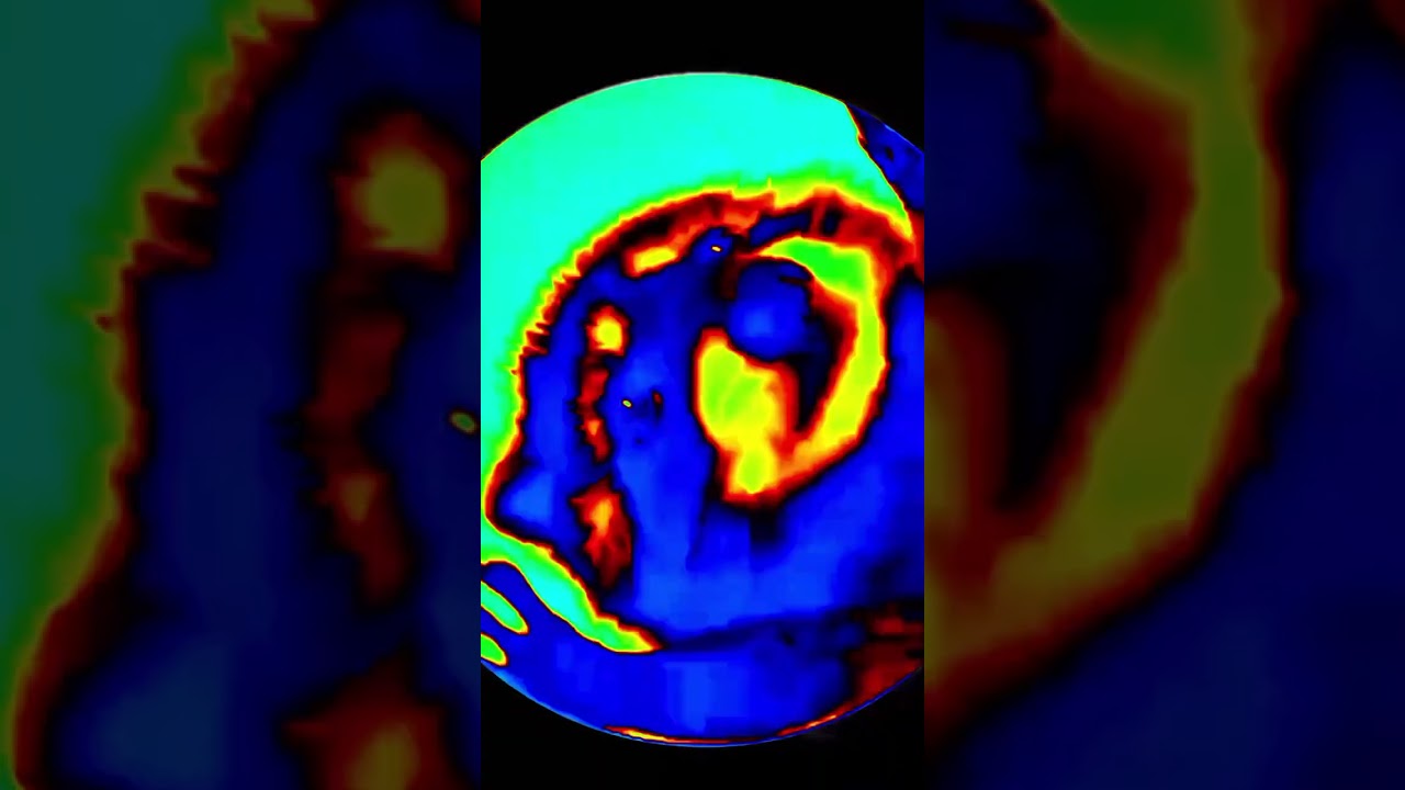 👽👽 . Music: Galactic Symphony by . #mandragora #rackoon #music #paytrance