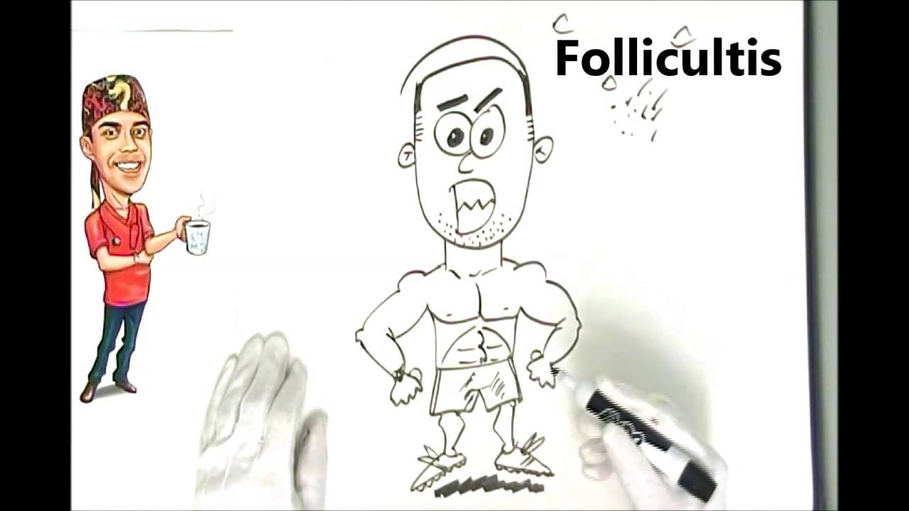 Folliculitis Razor Bumps Tub Rash Explained Simply