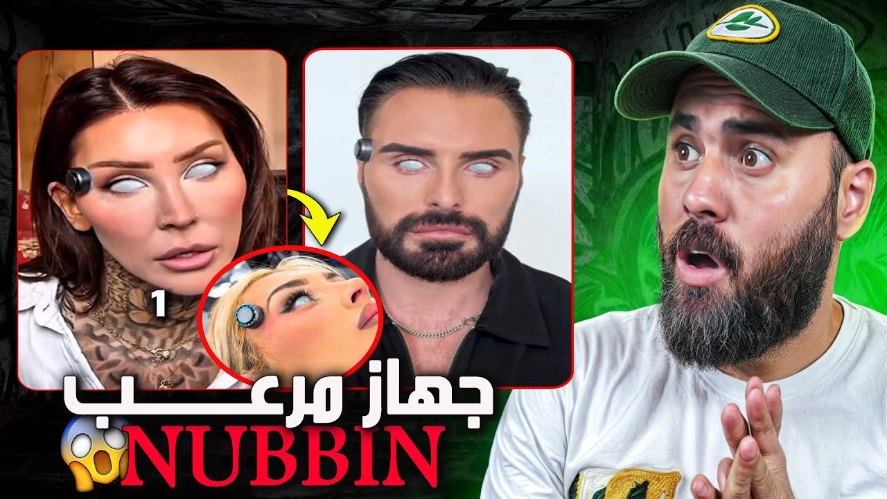 جهاز مرعـ ـــــب NUBBIN الذي يزرع على الرأس ويأخذك لعالم أفتراضي😲😱