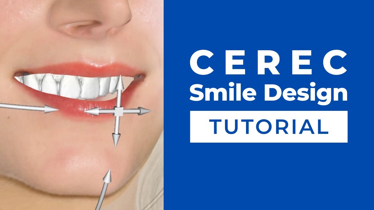 CEREC Smile Design Tutorial | How to Set Up and Use the Smile Design Function | CEREC Masterclass