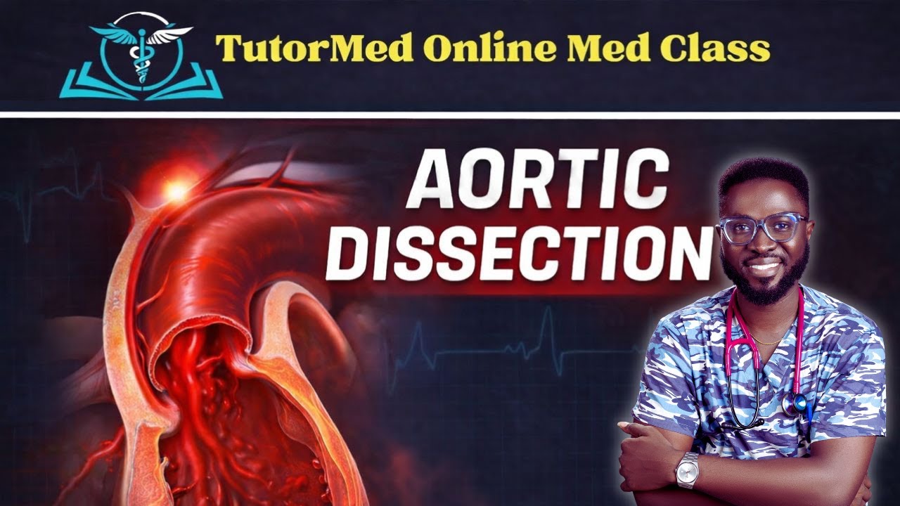 Расслоение аорты стало проще | Волшебство от TutorMed | Экзамен GMDC