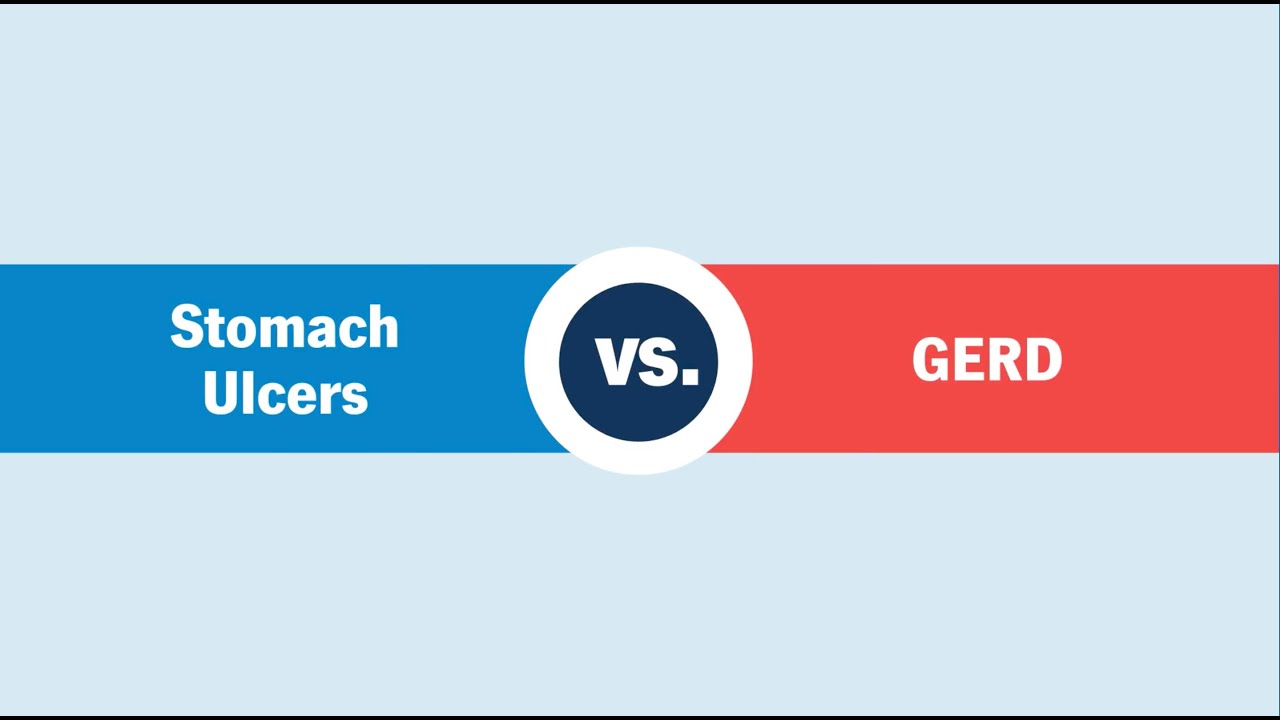 Acid 101: The Difference Between GERD vs. Stomach Ulcers