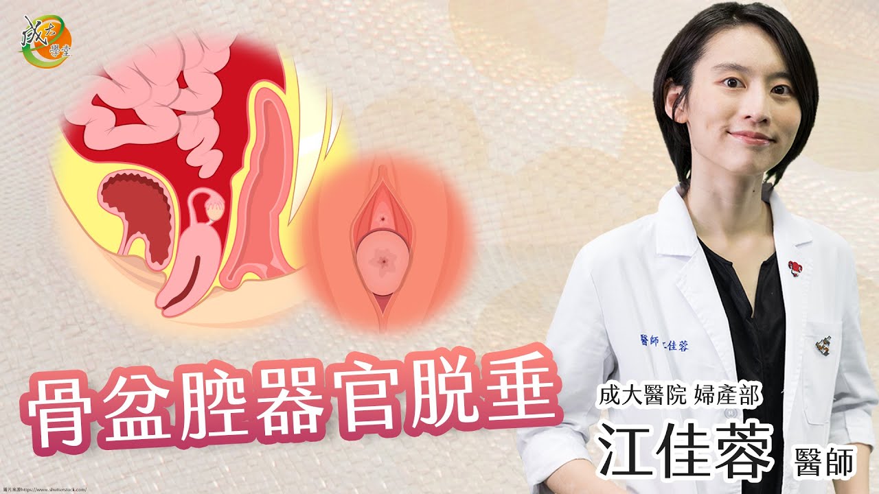 【骨盆腔器官脫垂】江佳蓉醫師-成大e學堂