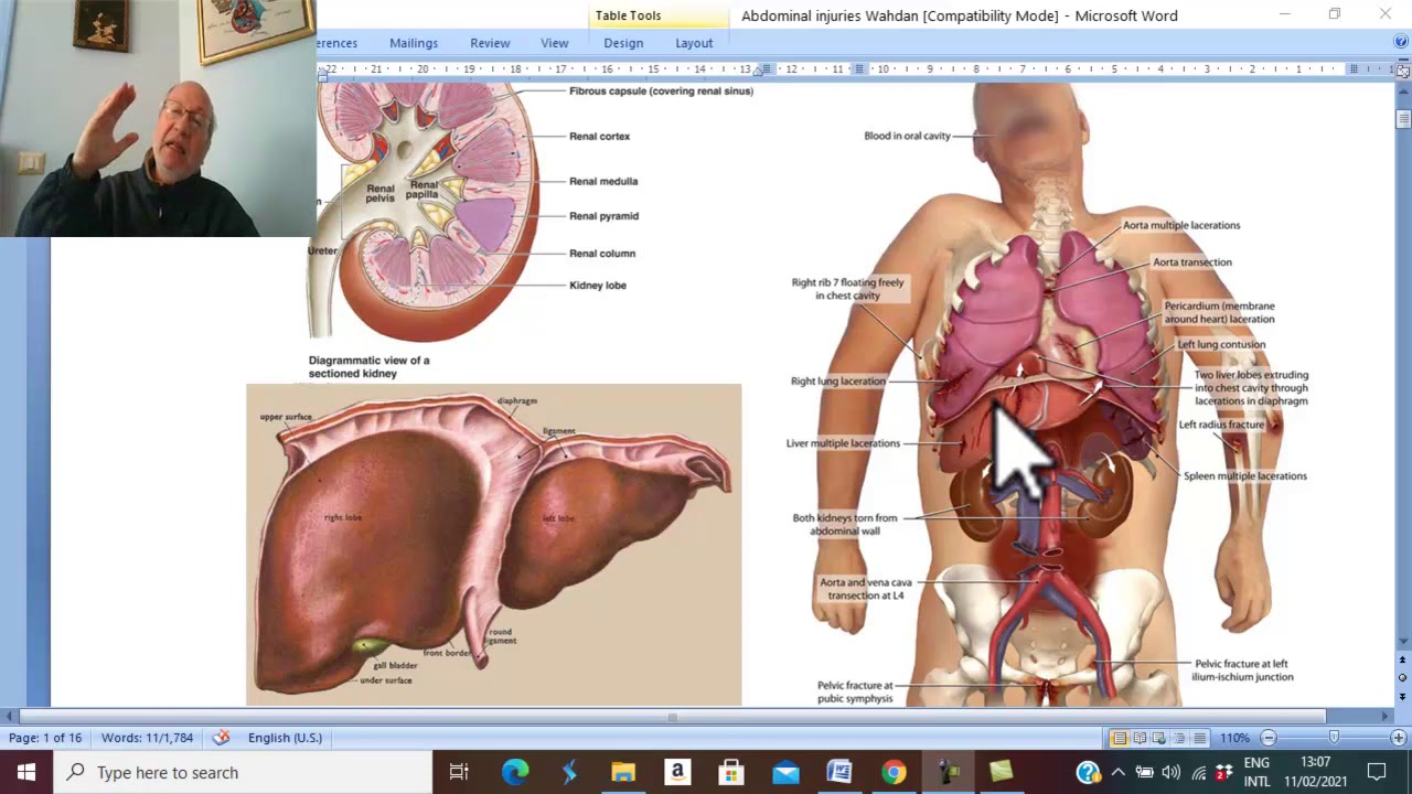 Trauma in Arabic 33 ( Hepatic Injuries ) , by Dr. Wahdan .