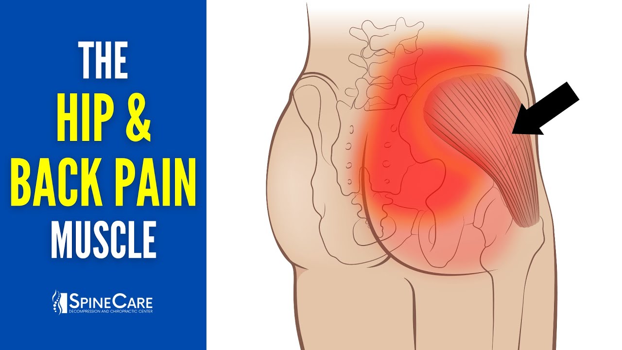 Боль в пояснице и бедре (как расслабить мышцы для мгновенного облегчения)
