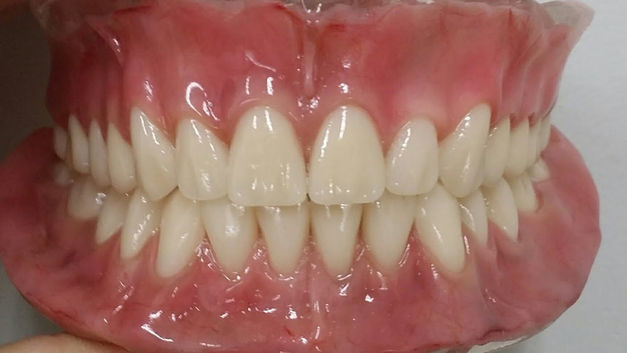 Como fixar mais a dentadura inferior