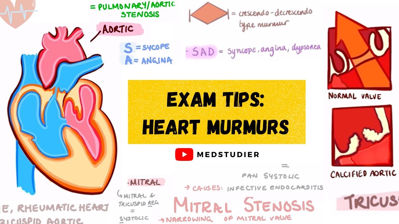 How to remember heart murmurs | Mnemonics, Diagrams & More | MedStudier