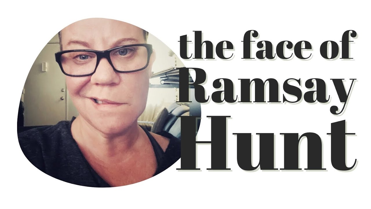 The Face of Ramsay Hunt and Recovery #ramsayhuntsyndrome #recovery #facialparalysis
