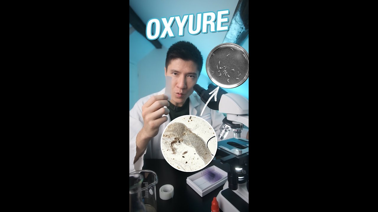 🔎 Zoom sur des Oxyures 🪱
