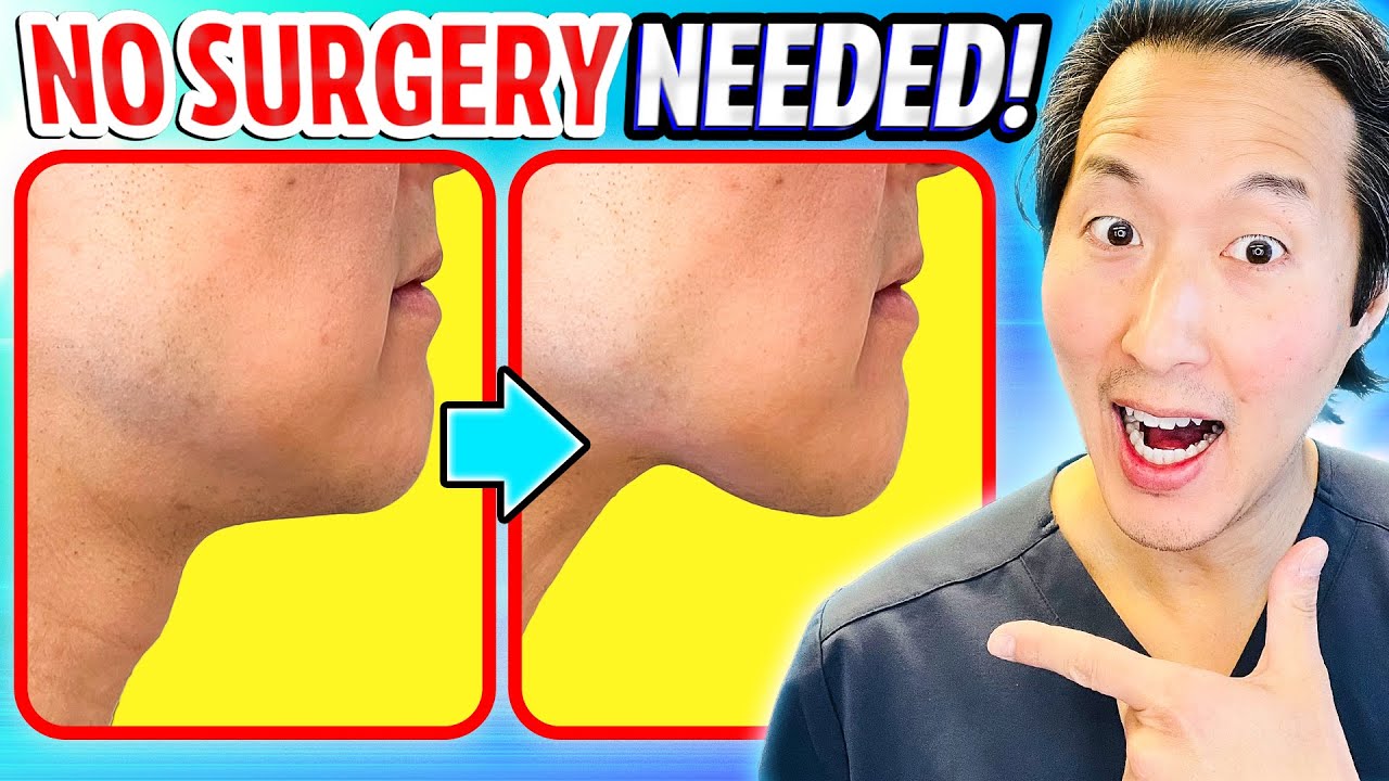 How To Get a Neck Lift Without Surgery the Holistic Way!