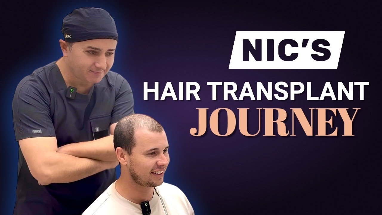 Norwood 6 Hair Transplant Journey with Dr Resul Yaman