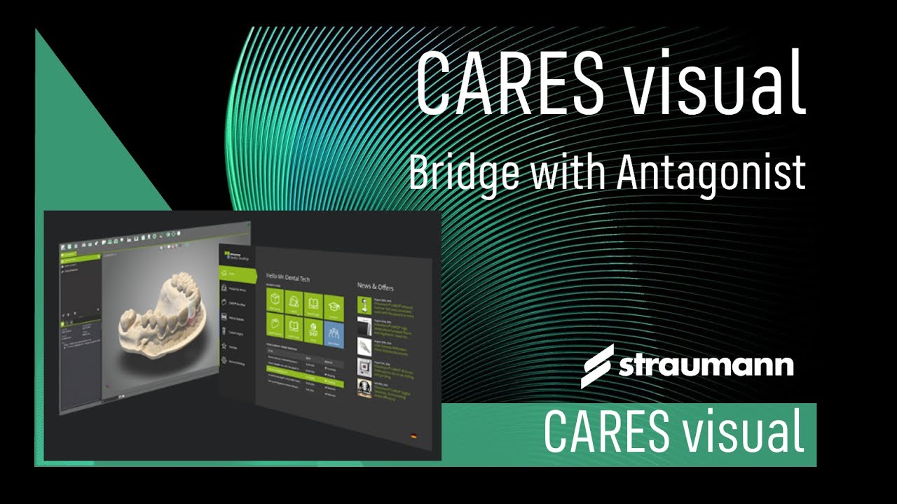 Bridge with Antagonist - Order, Scan and Design
