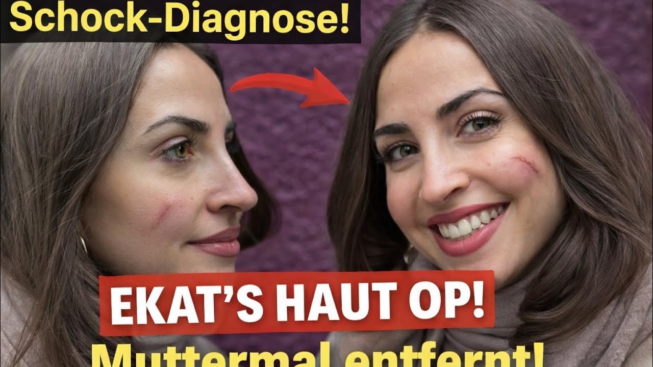 Schock-Diagnose! Ekaterina Leonova entfernt Muttermal – So geht es ihr jetzt
