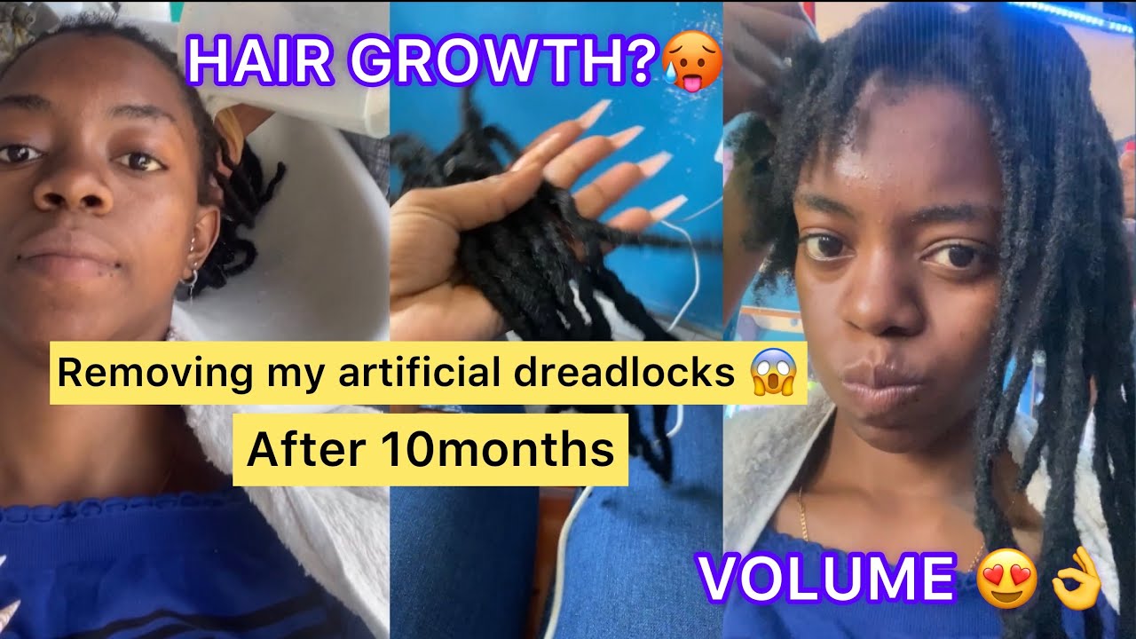Removing my temporary dreadlocks after 10months/was it really worth it?!/hair growth &volume