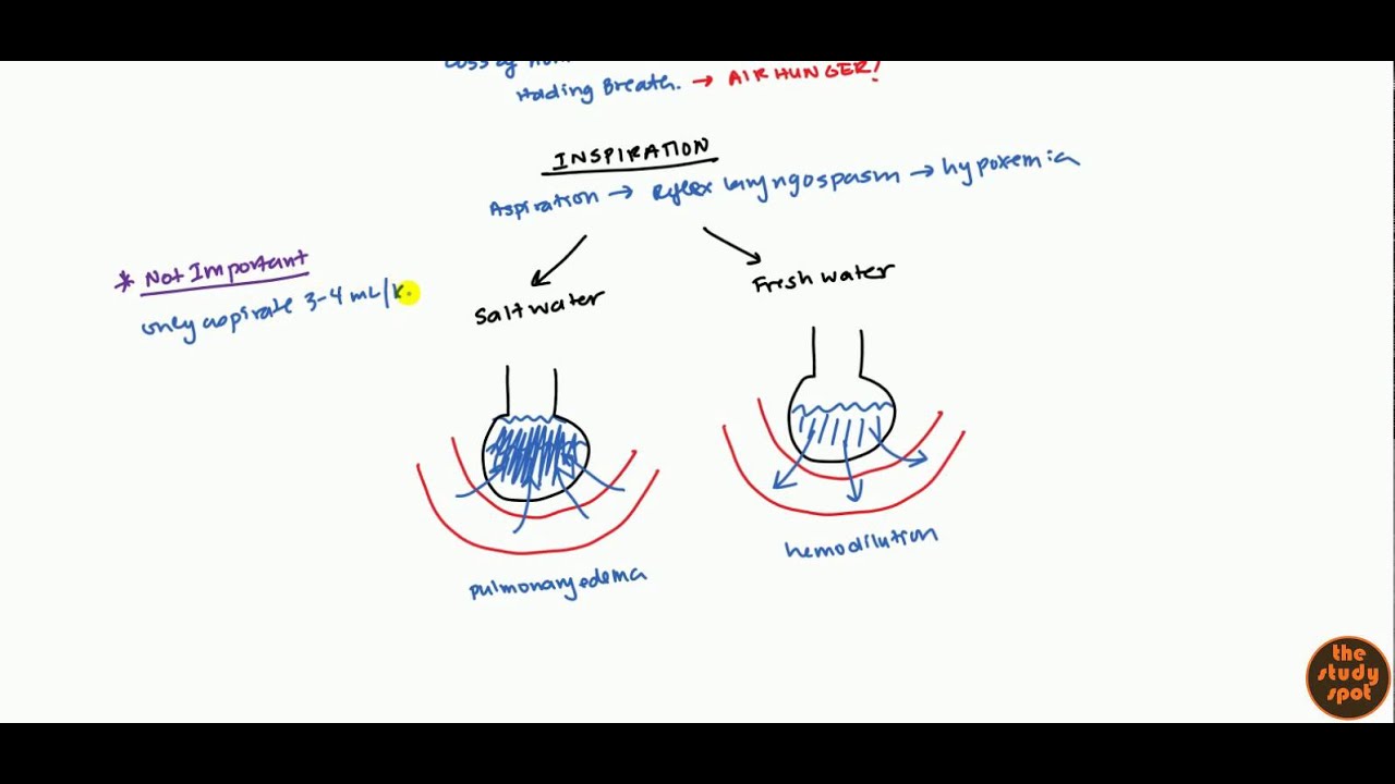Drowning (Pathophysiology and Management) for USMLE