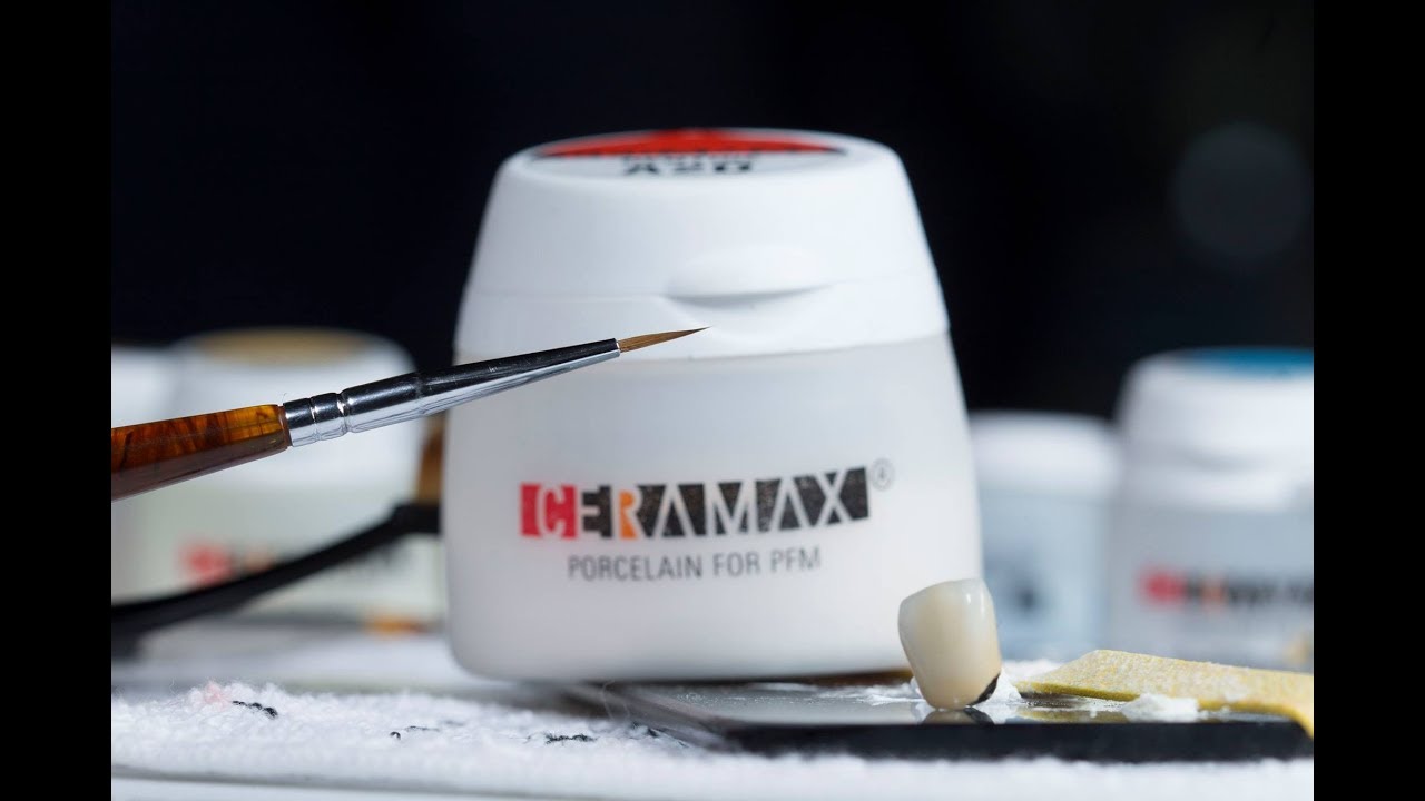 Montaje de Porcelana Ceramax, Técnica de Estratificado.