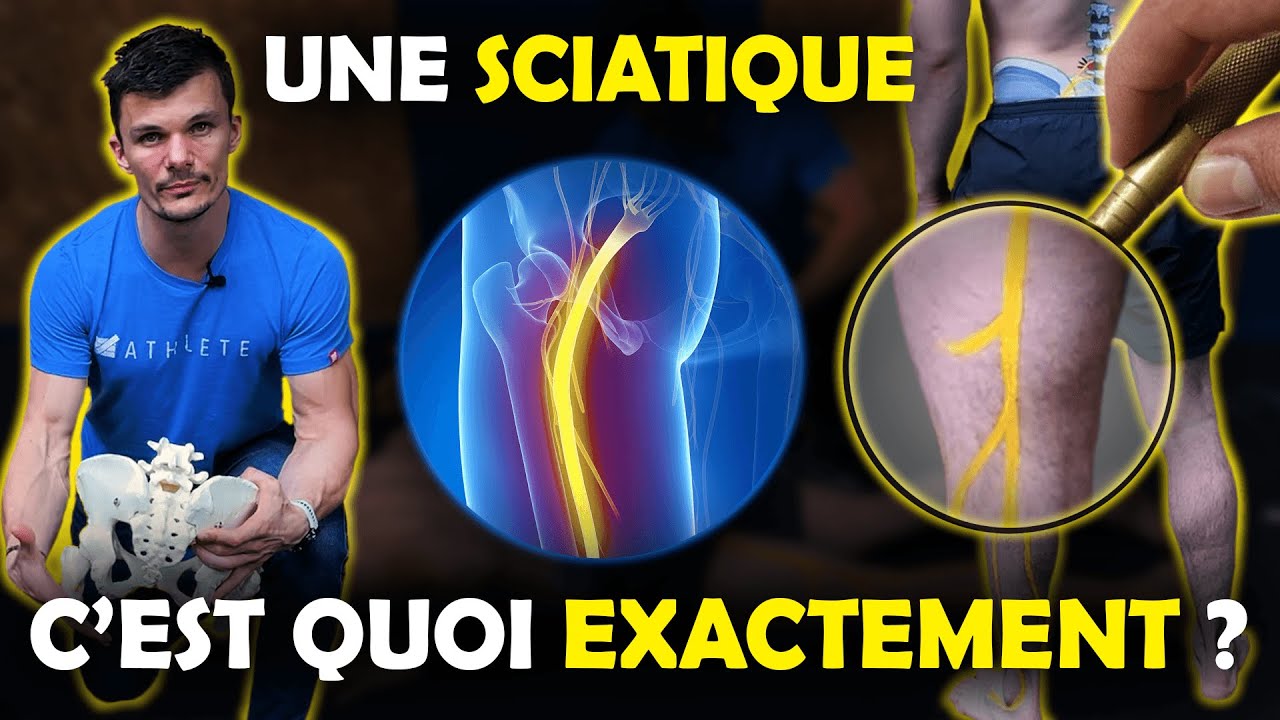 BODYPAINTING. Tout comprendre pour traiter efficacement « la sciatique »