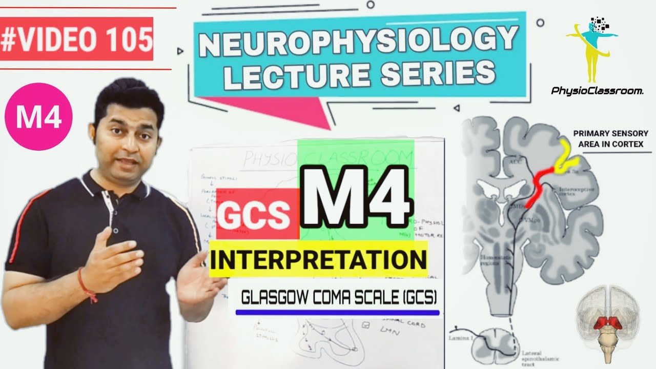GCS M4 INTERPRETATION : NEUROPHYSIOLOGY AND TREATMENT TIPS FOR M4 MOTOR RESPONSE PATIENTS