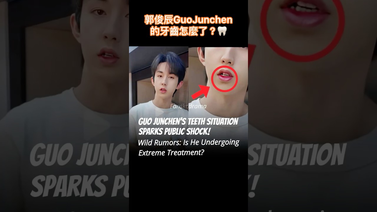 郭俊辰GuoJunchen的牙齒怎麼了？#GuoJunchen