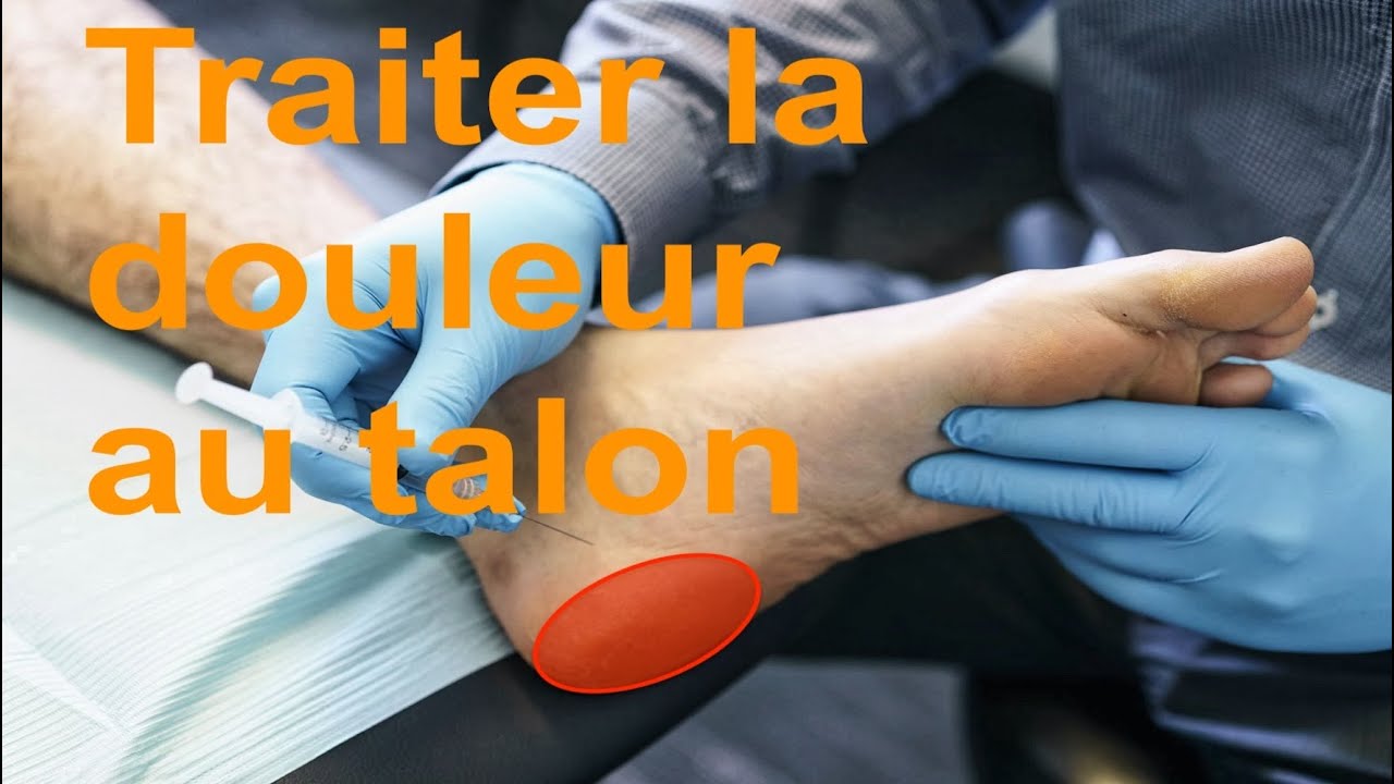 Guérir la douleur au talon - Fasciapathie plantaire ou Fasciite plantaire - en trois étapes faciles.