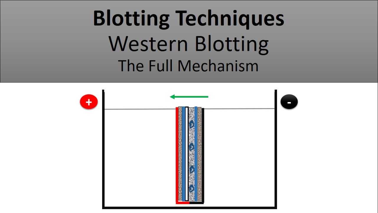 Blotting Techniques/ The Principle of Western Blotting