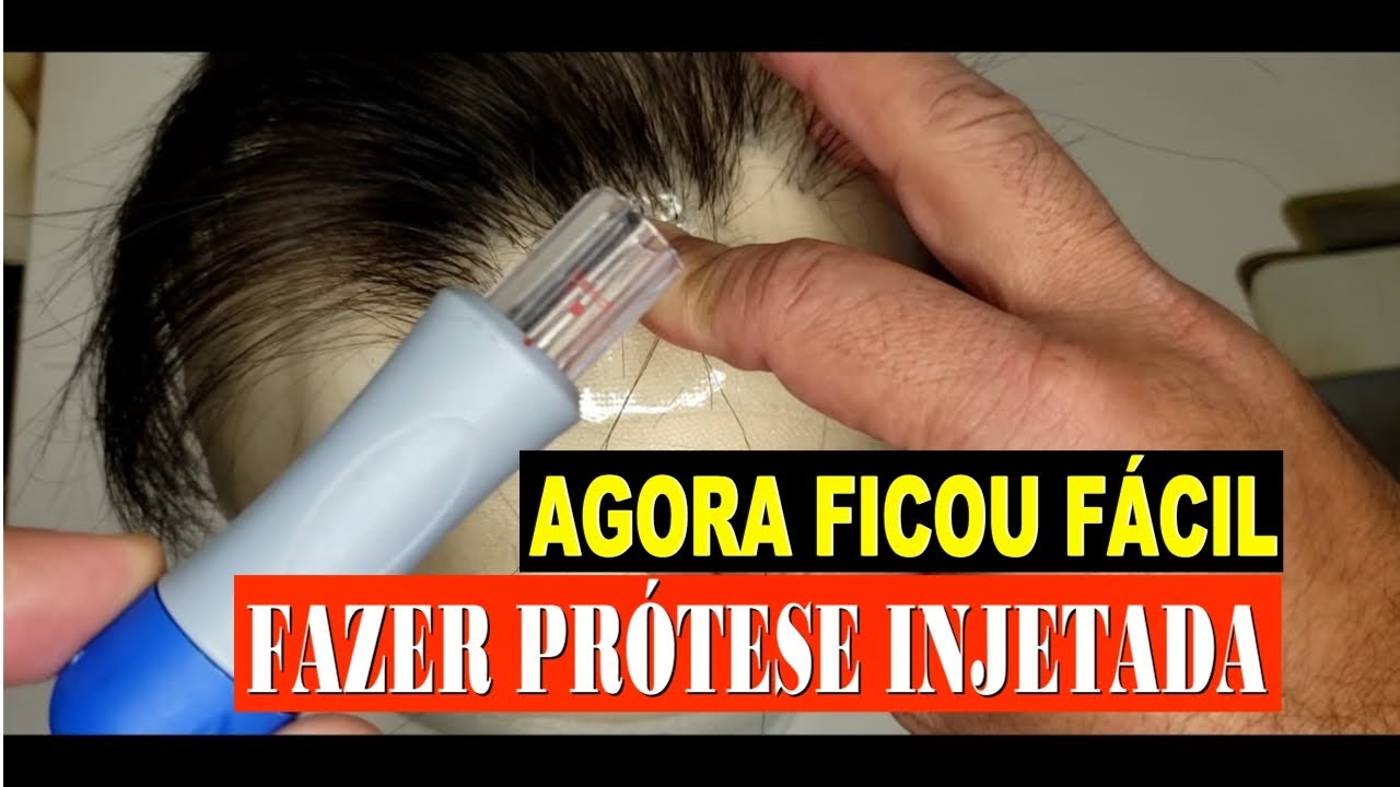 Como Fazer Protese Capilar - Agora ficou fácil - Melvis Cabelos