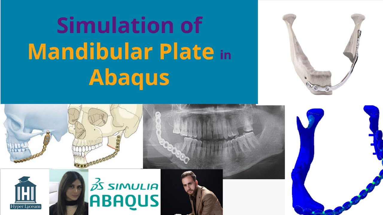 Simulation of mandibular plate in Abaqus