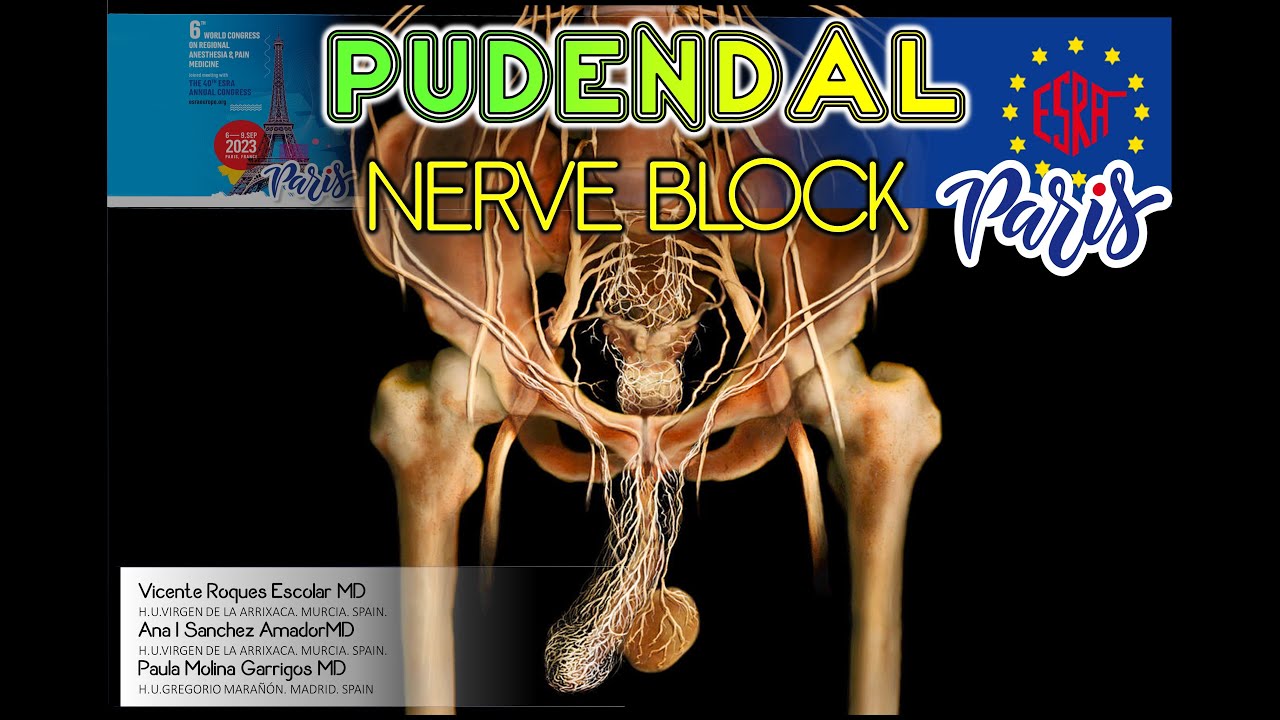 PUDENDAL NERVE BLOCK