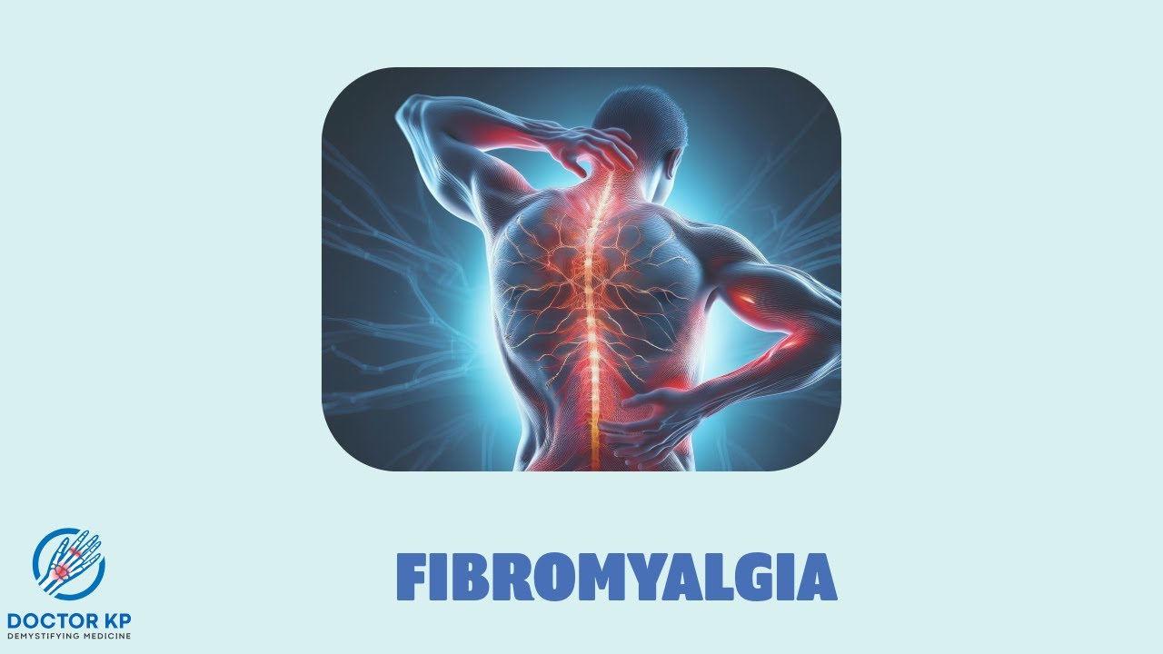 Fibromyalgia