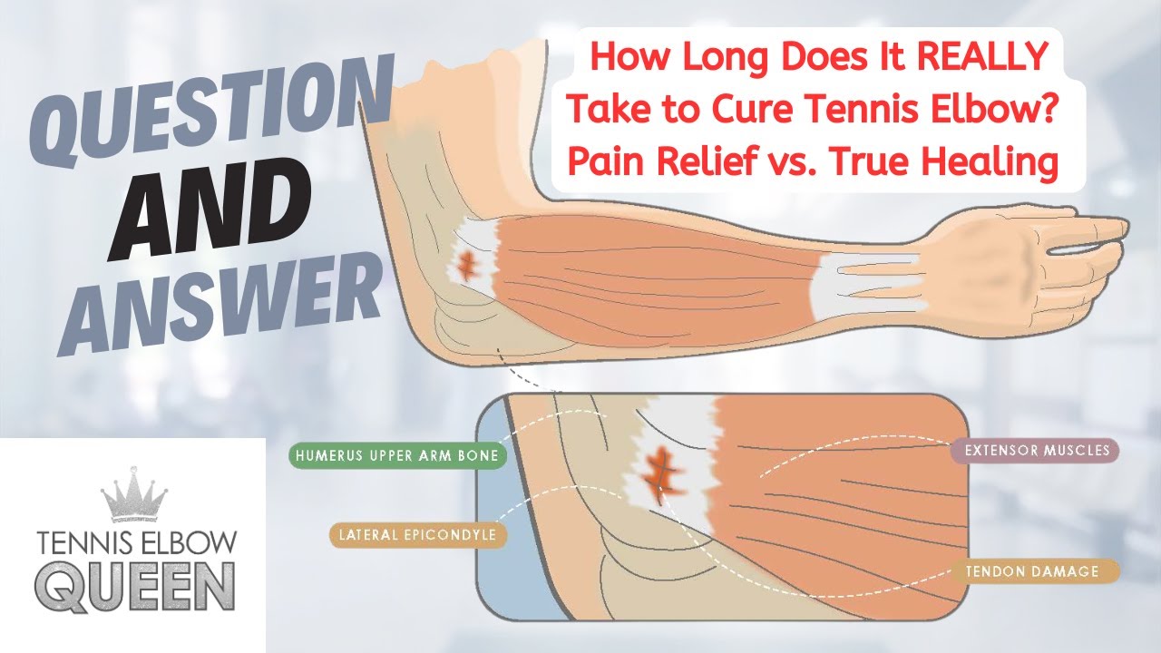 How Long Does It REALLY Take to Cure Tennis Elbow? Pain Relief vs. True Healing Explained