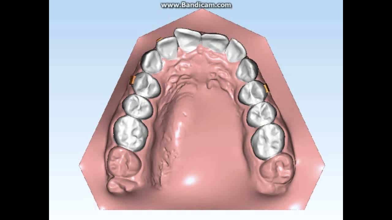 Ortodonzia Invisibile Aurodental 18022016