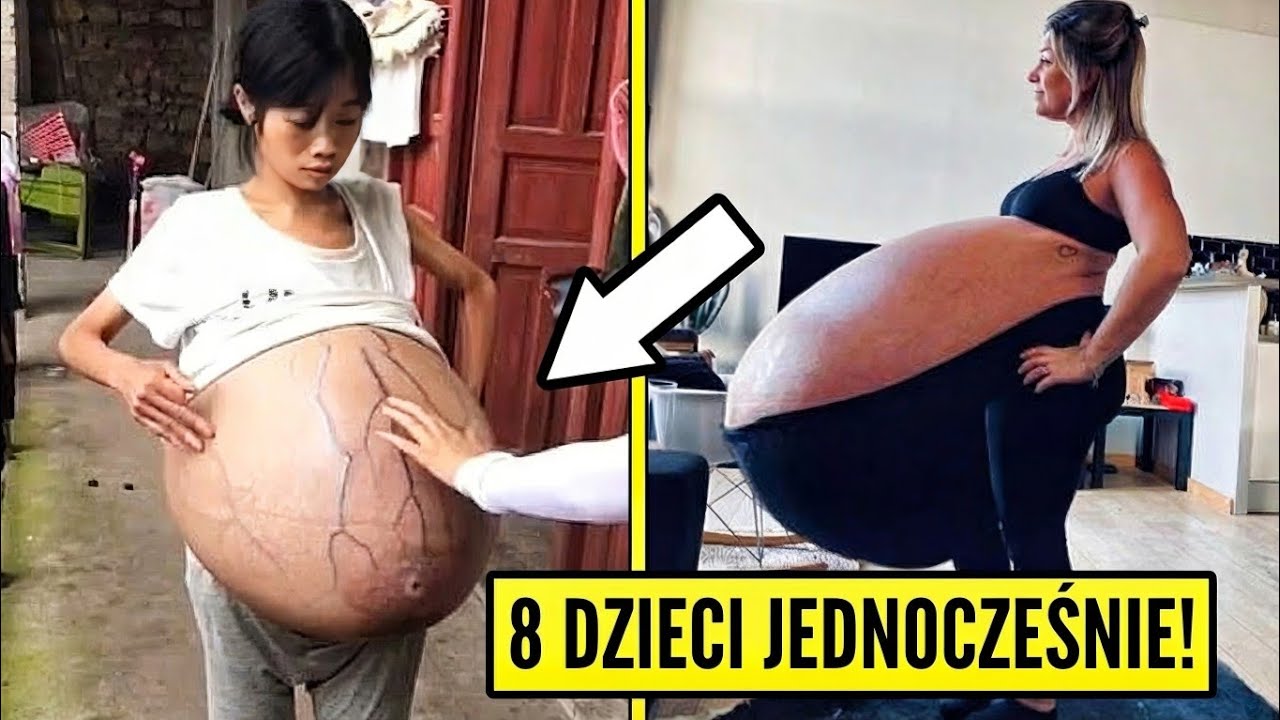 9 ciąż, kt&oacute;re rzuciły wyzwanie nauce i ludzkiej logice