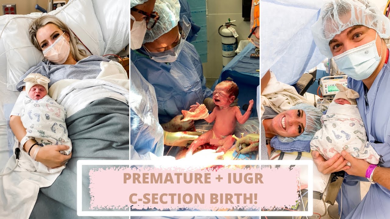 BLAKELY'S BIRTH STORY | IUGR PREEMIE | * RAW EMOTIONAL FOOTAGE * | C SECTION