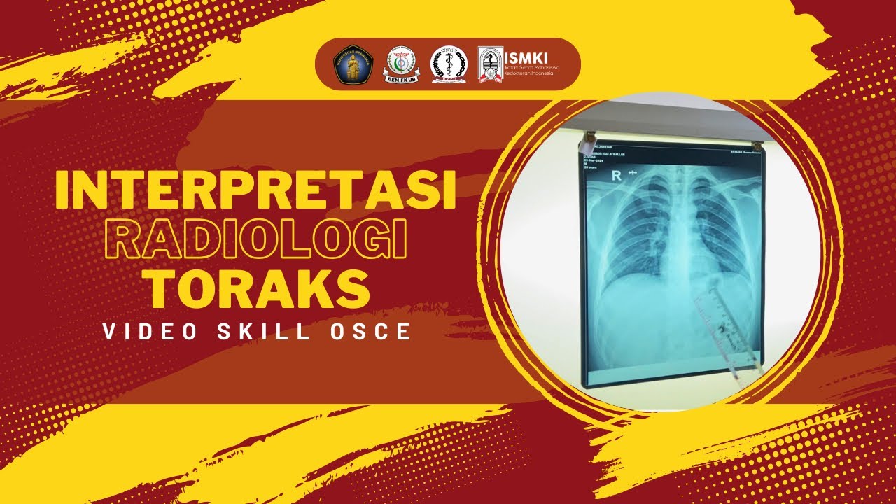 [VIDEO SKILL OSCE - INTERPRETASI RADIOLOGI THORAX]