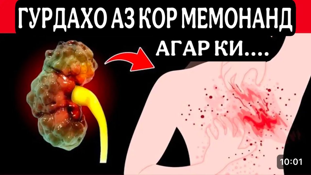 Аломатхои хатарноке, ки аз норасогии гурдахо хабар медиханд!